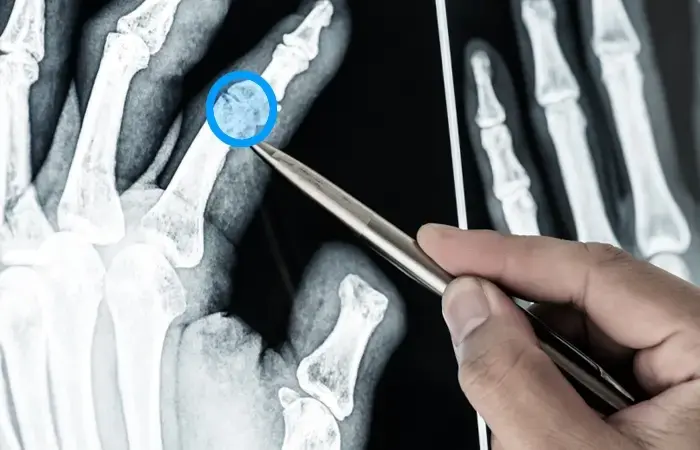 Annotation for Point of Interest in X-Rays